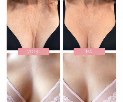 Nyghtt Anti-Aging Borstkussen